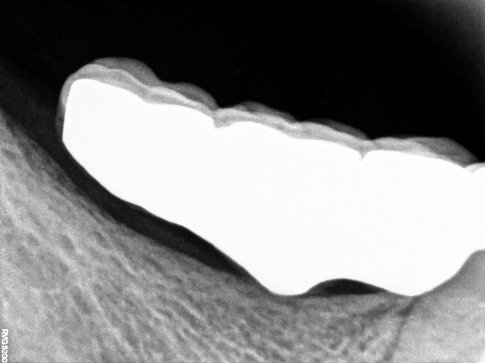Dental X-ray